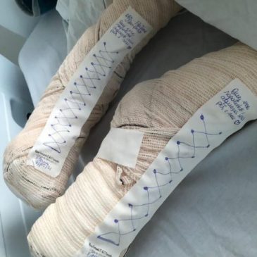 Técnica de enfermagem diz que fez ‘sapatinhos’ para aquecer pés de paciente como forma de carinho